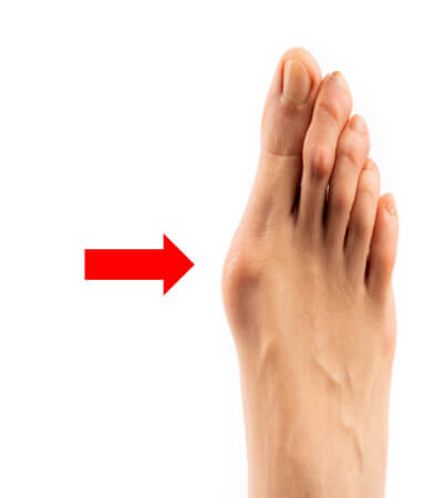 Foot Pain