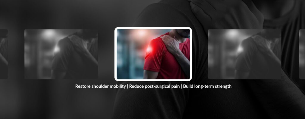 How to Recover from Shoulder Pain After Surgery